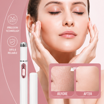 Mole & Wart Removal Laser Pen