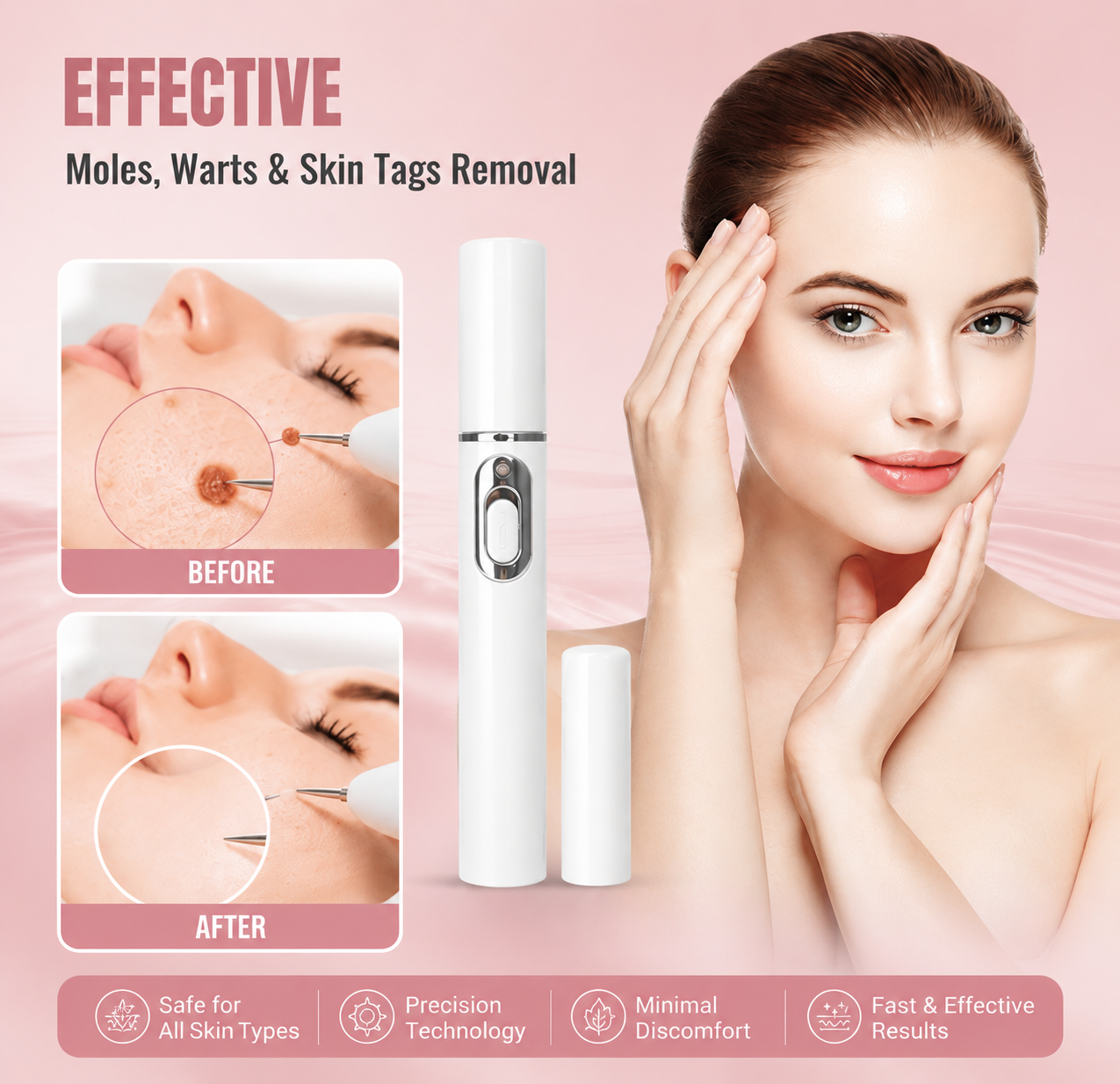 Mole & Wart Removal Laser Pen